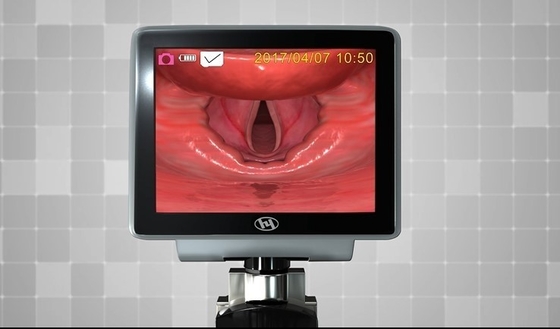 HYHJ 1320 Metalowy plastikowy wideolaryngoskop światłowodowy z jednorazowymi ostrzami