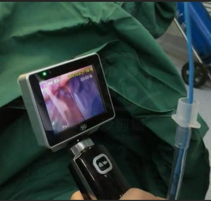 ICU EMS Jednorazowy wideolaryngoskop do intubacji z rozdzielczością kamery 1280 X 720