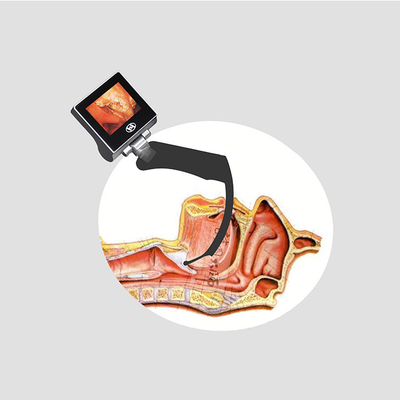 360 stopni All Sight LCD Medical Rigid Video Laryngoscope Set Akumulator