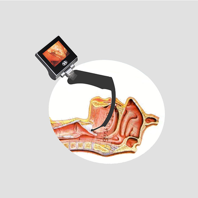 3,0-calowy ekran LCD Airway Jednorazowy wideo laryngoskop 960 * 480 pikseli
