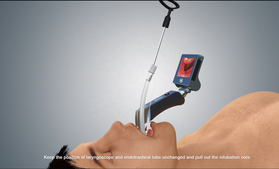 Jednorazowy wideolaryngoskop do intubacji 3-calowy LCD 1280*720 Px