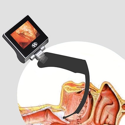 Wideo Laryngoskop anestezjologiczny 360 stopni LCD wielokrotnego użytku 2 miliony pikseli