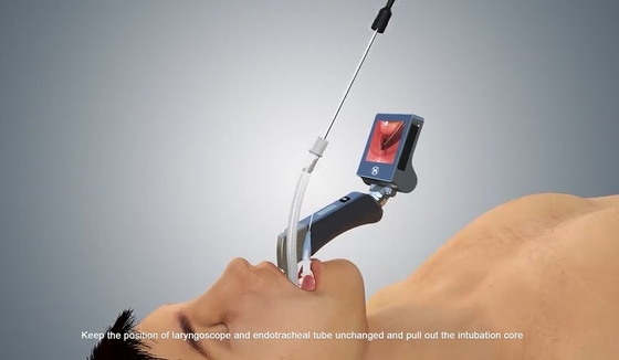 Haiye Medical Przenośny jednorazowy wideolaryngoskop USB EMS z 6 metalowymi ostrzami
